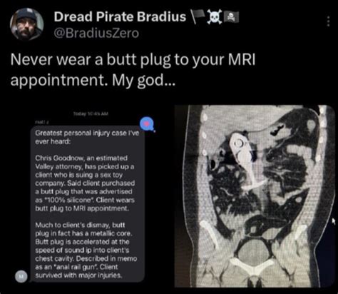 butt plug mri|mri to ct story.